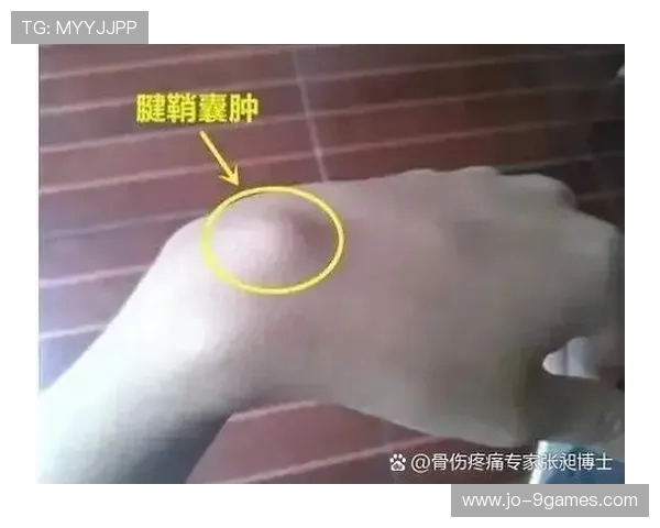 经常打游戏大拇指难受怎么办 如何有效缓解手指疲劳与不适